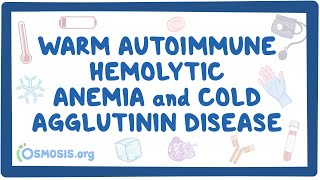 Warm autoimmune hemolytic anemia and cold agglutinin NORD [upl. by Clarette]