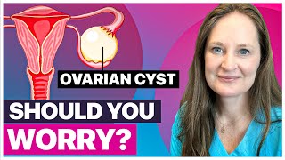 What is Ovarian Cysts  Types Causes and Symptoms [upl. by Ellwood]