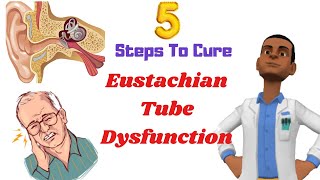 5 Steps to Cure Eustachian Tube Dysfunction LIVE  Healing at Home  Jaye Wellness [upl. by Jori46]