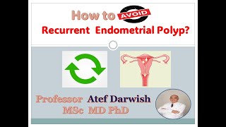 How to avoid Recurrent Endometrial polyp [upl. by Mcquade]