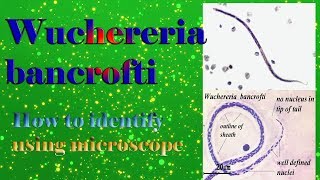 Wuchereria bancrofti under microscope  How to identify from other Microfilaria [upl. by Humphrey]