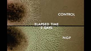 8 Response of Cells to Nerve Growth Factor NGF [upl. by Sirrep358]