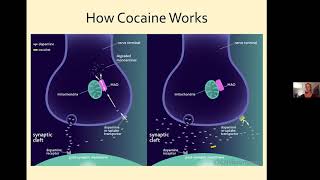 The Brain Disease Model of Addiction [upl. by Leffert]