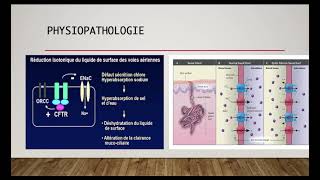 La mucoviscidose  physiopathologie [upl. by Zenitram]