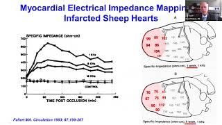 Biophysics of Pulsed Electrical Field Ablation [upl. by Maril]