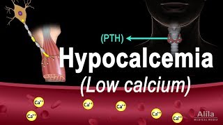 Hypocalcemia Low Calcium Pathology Causes Symptoms and Treatment Animation [upl. by Nalehp]