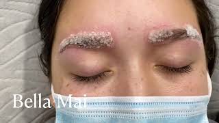 Eyebrow Salt and Saline Removal [upl. by Esital]