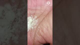 Remove Facial Hair  Remove unwanted hair [upl. by Aenehs]