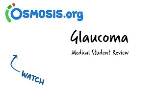 Glaucoma  Clinical Presentation [upl. by Llennor]