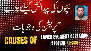 CAUSES OF LOWER SEGMENT CASERIAN SECTION LSCS C SECTION [upl. by Ellives]