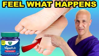 What are the benefits of using Vicks on your feet [upl. by Jorrie]