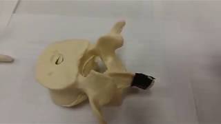 Typical Vertebra Parts 1 of 2 [upl. by Iral315]