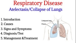 Atelectasis  Introduction causes signs ampsymptoms diagnosis and treatment  Respiratory disease [upl. by Artenak]