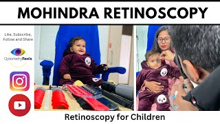 How to perform Mohindra Retinoscopy  Near Retinoscopy  Retinoscopy in Children optometryreels [upl. by Yttap806]