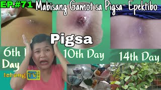 PIGSA Mabisang Gamot sa Pigsa Pigsang Dapa o Walang Mata  Proven Effective [upl. by Ecilahs789]