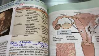 Neoplasia Part 1General Pathology Robbins [upl. by Sylado]