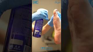 FUNGUS FOOT CARE fungus footcare podologia podology foothealth [upl. by Animor]