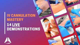 Intravenous IV cannulation compilation with demonstration of 14 procedures [upl. by Uria]