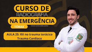 Trauma torácico  Trauma cardíaco [upl. by Eidua837]