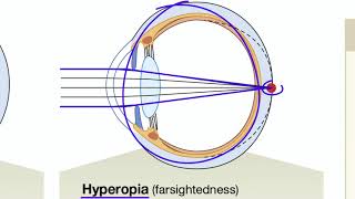 Light Refraction and Focused Vision in the Eye [upl. by Ardeahp]