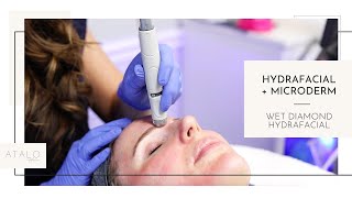 Best Microdermabrasion Technique  Wet Diamond Tip Hydrafacial [upl. by Demetre693]