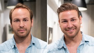 From Baldness to Summer Hairstyle 2018  Haarersatz Transformation  Hairsystems Heydecke [upl. by Wolfy]