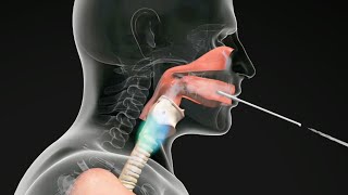 How do Straw Exercises Help the Voice Get Better voicetherapy [upl. by Algie]