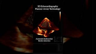 3D Echocardiography  Planner Array Technology makes endocardial border detection easy [upl. by Astri]