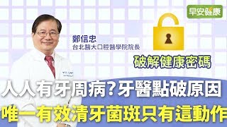 人人有牙周病？牙醫點破原因：唯一有效清牙菌斑只有這動作  台北醫大口腔醫學院長鄭信忠牙醫師【早安健康】 [upl. by Devinne]