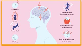 Tipos de crisis epiléptica crisis focales y generalizadas [upl. by Anderegg]