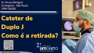 Como é retirado o Cateter de duplo J O que é importante saber para se preparar [upl. by Ailana]