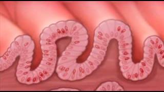 Esophagitis Esophagus Inflammation Signs amp Symptoms amp Why They Occur [upl. by Aeslahc41]