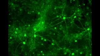 Neuronal synchronized firing  Calcium oscillation in neurons [upl. by Elfrieda]