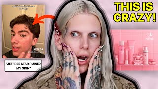 Jeffree Star Skin Causing Skin DAMAGE [upl. by Ileray]