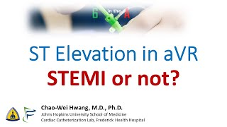 ST Elevation in aVR STEMI or not [upl. by Auqinet]