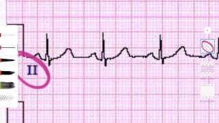 ECG  Derivaciones y caras  1 Ciclo cardiaco básico [upl. by Myriam]