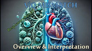 VQ Mismatch Critical Care  Part 01 of 02  Pulmonary Series  Recorded Live [upl. by Puritan14]