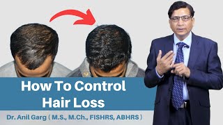 Top 5 Hair Loss Solutions That Actually Work [upl. by Acisey373]