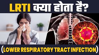 COPD Exacerbations [upl. by Madox]