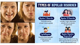 WESTERN DIAGNOSIS OF BIPOLAR DISORDER [upl. by Jourdain]