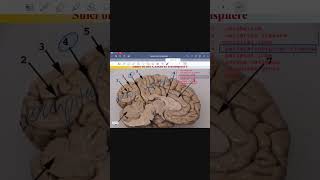 neuroanatomy of cerebral hemisphere [upl. by Lothair824]