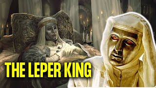 What Really Happened To The Leper King  Baldwin IV of Jerusalem [upl. by Storer]