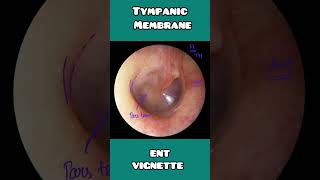 Tympanic membrane anatomy under 60 seconds  USMLE NCLEX  NEET PG [upl. by Dorena]