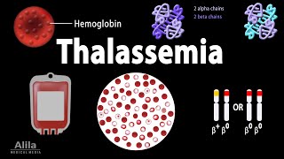 Thalassemia Alpha amp BetaThalassemias Genetics Pathophysiology Diagnosis amp Treatment Animation [upl. by Edveh782]