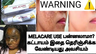 MELACARE CREAM SIDEEFFECTS TAMILSKIN WHITENING CREAM REVIEWTRENDING BEAUTY TIPS [upl. by Philippe]