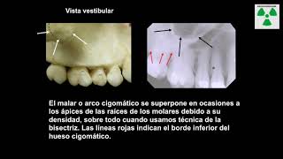 Anatomía radiológica Maxilar y mandibular [upl. by Eiro]