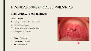 Faringoamigdalitis [upl. by Eusebio]