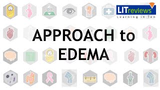 Approach To Edema [upl. by Sedinoel]