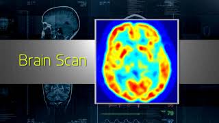 Understanding Nuclear Medicine [upl. by Nicolas]