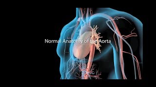 Ultrasound of Abdominal Aortic Aneurysm AAA [upl. by Sudhir954]